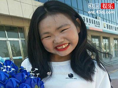 网红缺牙嘟嘟妹身世也太可怜了 无盛世美颜的嘟嘟妹宛如一股清流