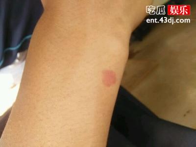 守宫砂起源是什么时候？真的可以鉴别是不是处女吗？