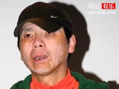 冯小刚病情恶化让人让人心疼！他的妻子说出了他放弃治疗的真正原因