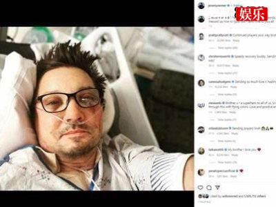 “鹰眼”晒术后自拍，面部大片淤血事故原因曝出