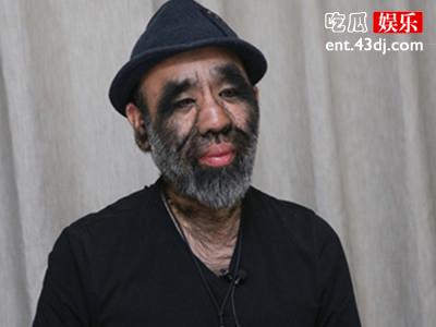 还记得中国第一毛孩？他结婚啦！
