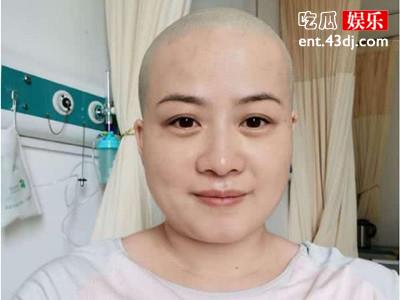 岳云鹏老婆回应生病剃光头！ 她得了什么病身体现状如何