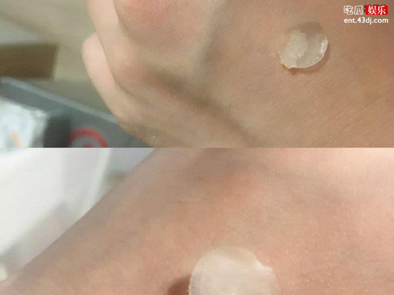 油痘肌女生该如何美白祛痘，这款产品一定要有！