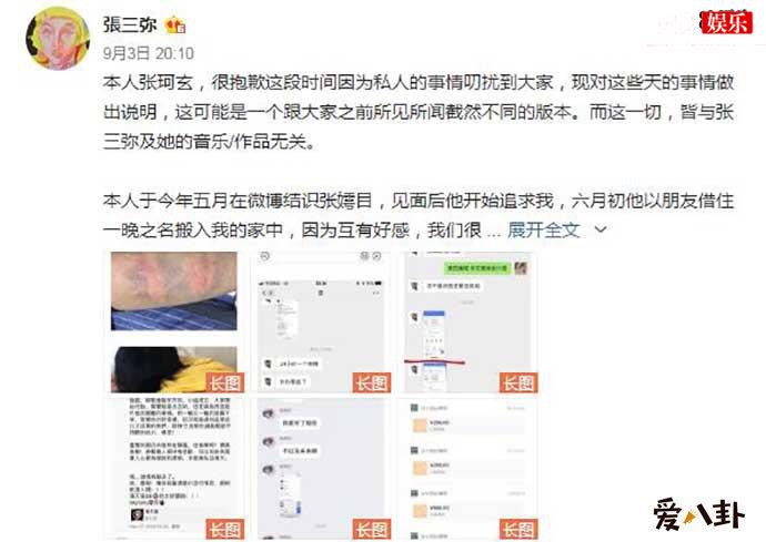 张嫮目疑家暴