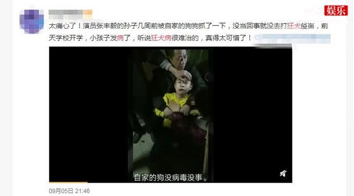 网传张丰毅孙子被狗咬伤得了狂犬病