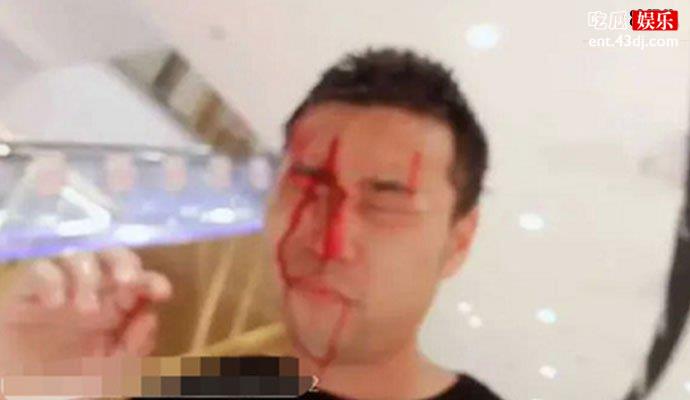 钱小佳被打照片