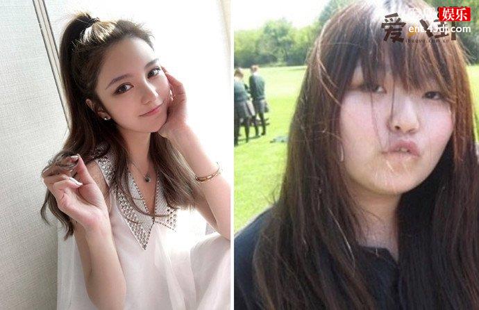周扬青整容前后对比