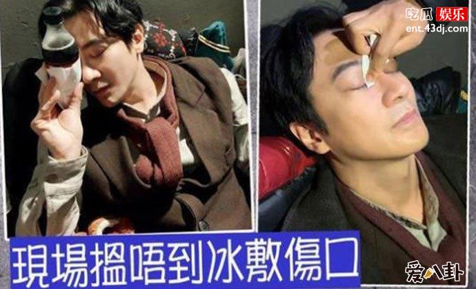 孙耀威被打伤眼角