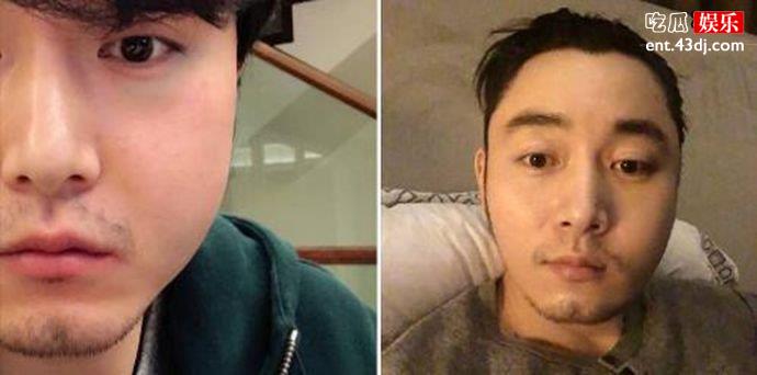 李东学毁容照片