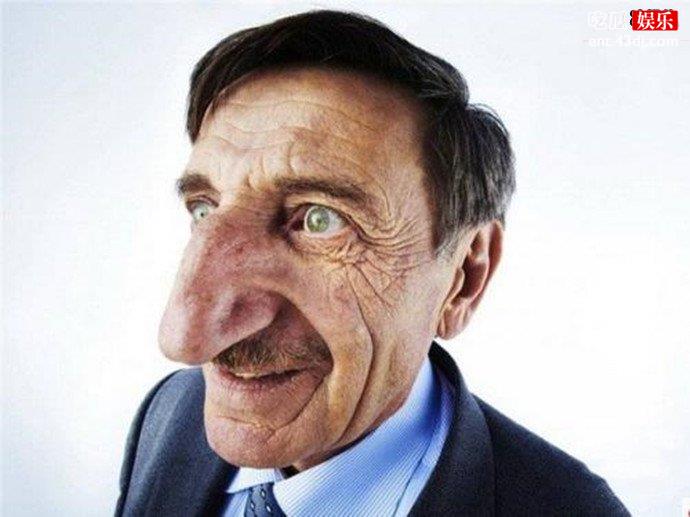 世界上最大的鼻子