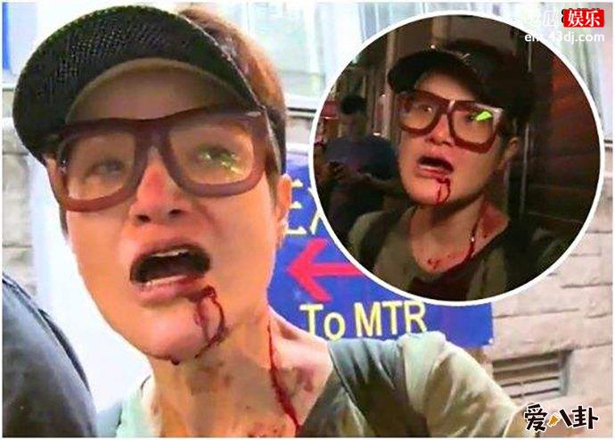 TVB女艺人马蹄露遭暴徒殴打