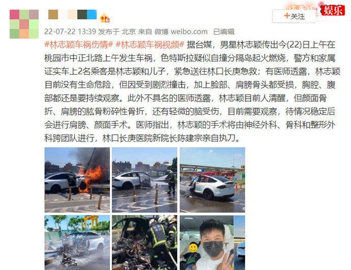 林志颖伤情需手术