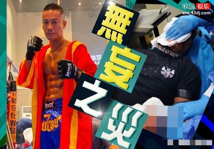 港星黄竣锋遇袭被砍三刀