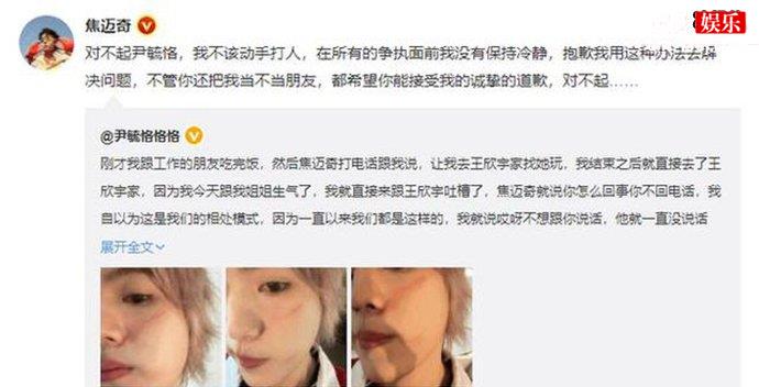 焦迈奇为什么打尹毓恪